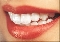 Implantes dentários e estética em Curitiba